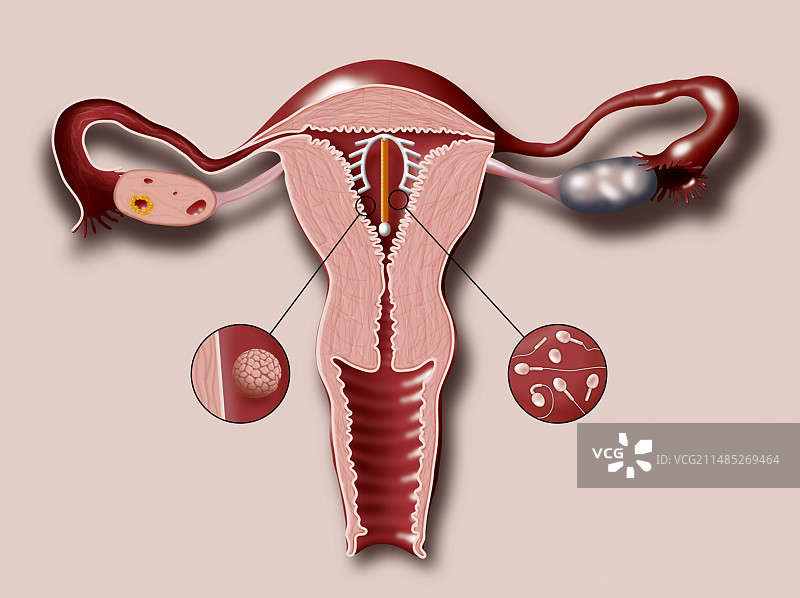 子宫内的避孕环图片素材