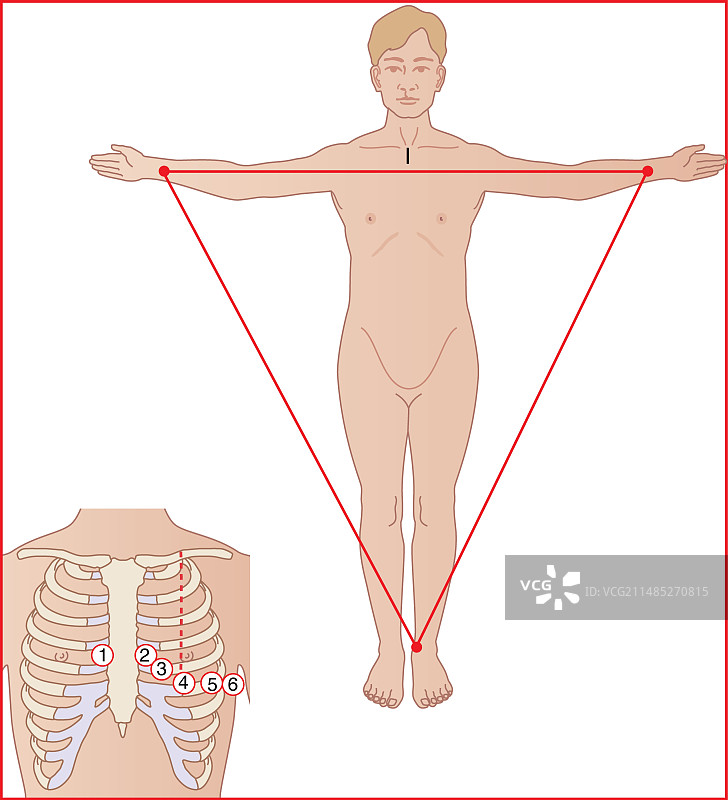 心电图电极放置示意图图片素材