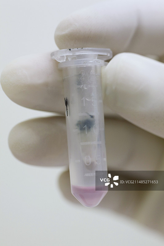 疟疾疫苗研究图片素材