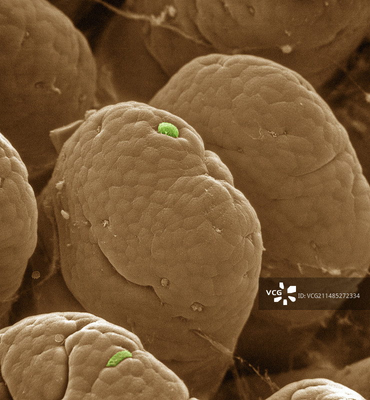 肠道绒毛细胞损失，扫描电镜图片素材