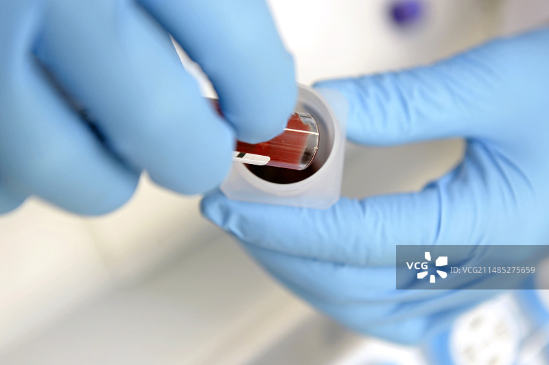 医院血液检测图片素材