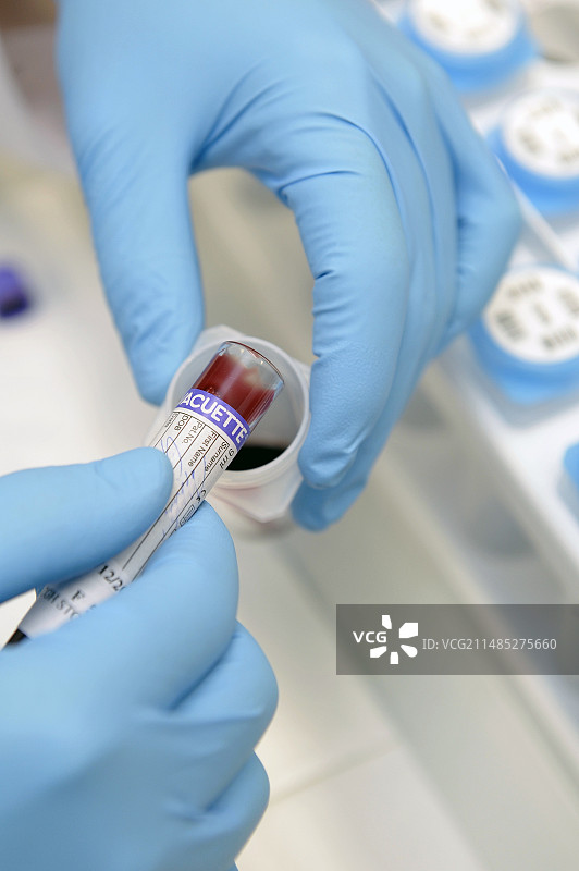 医院血液检测图片素材