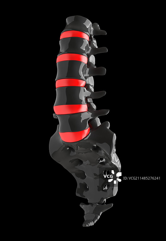 腰椎和骶骨，艺术作品图片素材