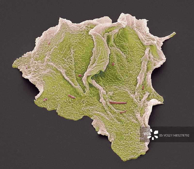 颊鳞状细胞扫描电镜图图片素材