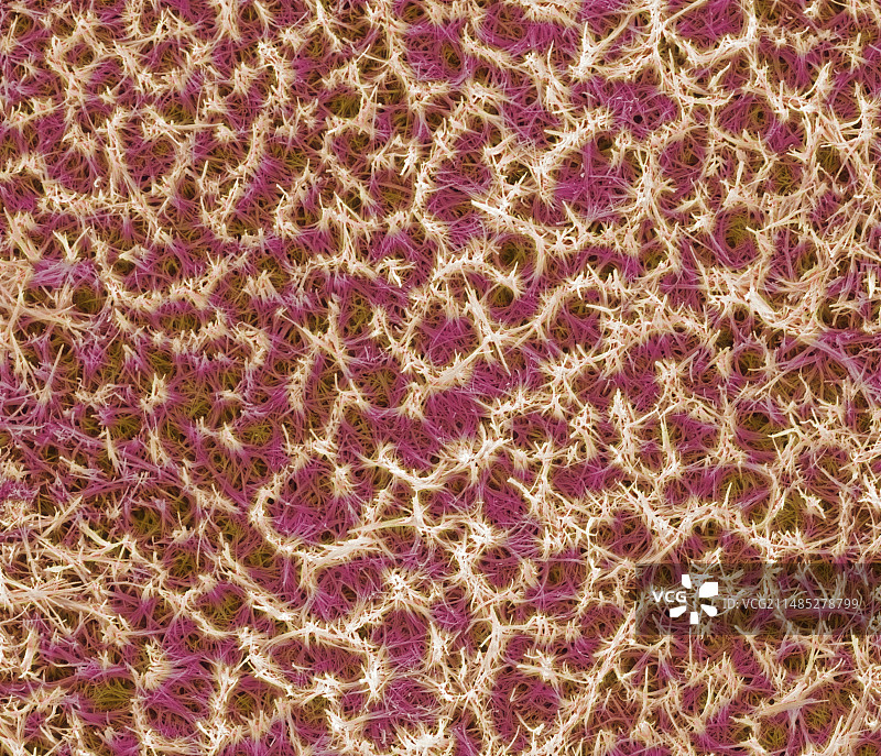 肾结石晶体扫描电镜图图片素材