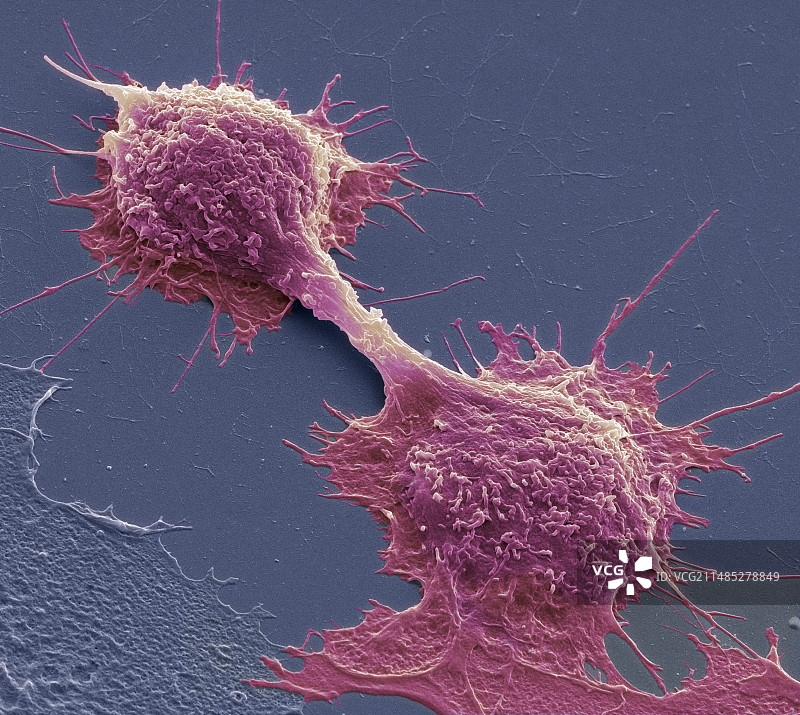 癌细胞分裂，扫描电子显微镜图片素材