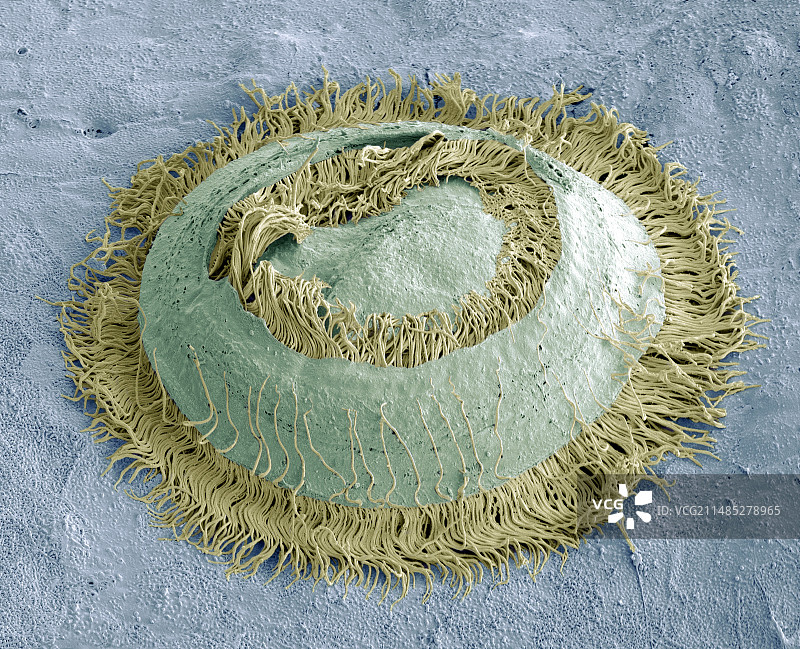 车轮虫寄生虫扫描电镜照片图片素材