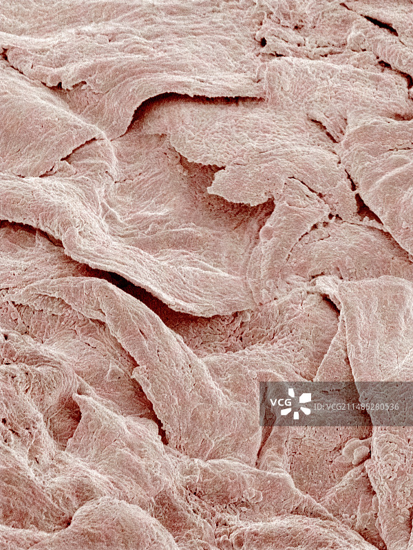 皮肤表面扫描电镜图图片素材