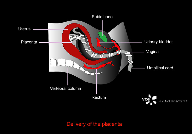 胎盘排出，艺术作品图片素材