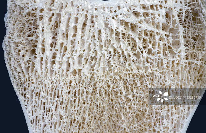 股骨远端截面图片素材