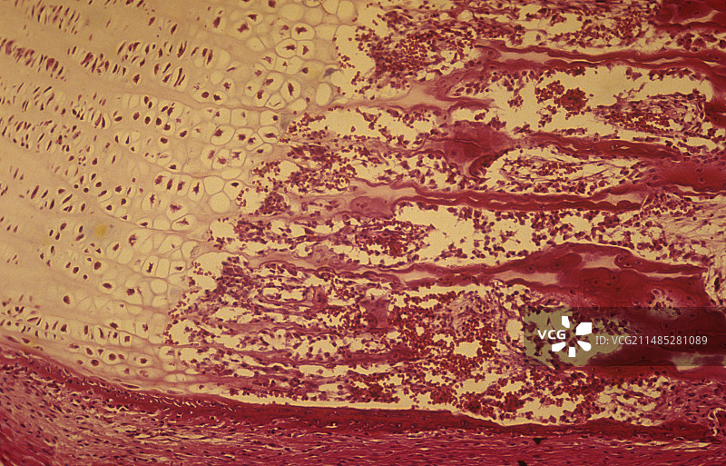 人类长骨和骨髓发育图图片素材