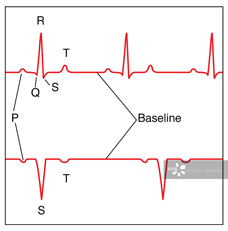 正常心率心电图艺术作品图片素材