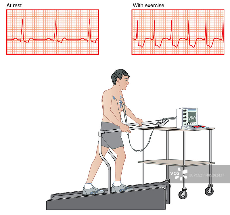 心脏压力测试艺术作品图片素材