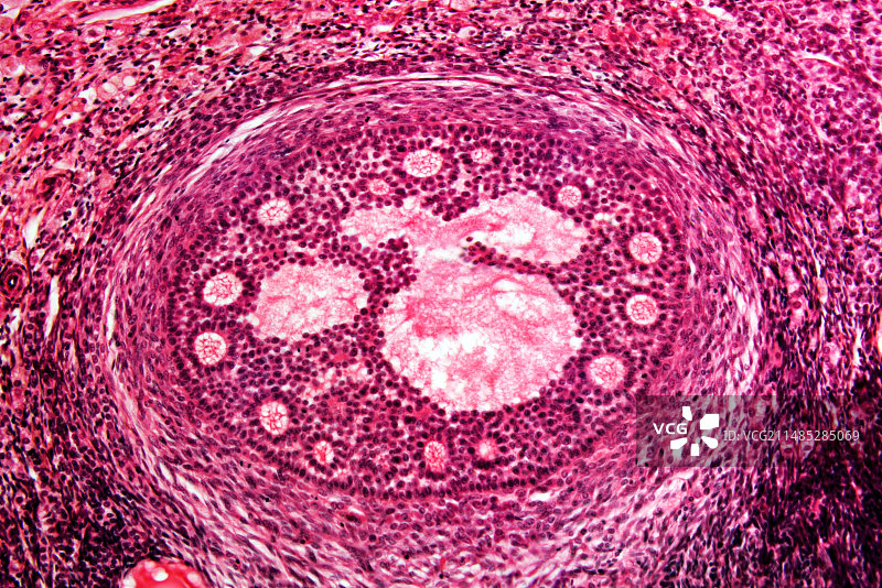 卵巢卵泡显微照片图片素材
