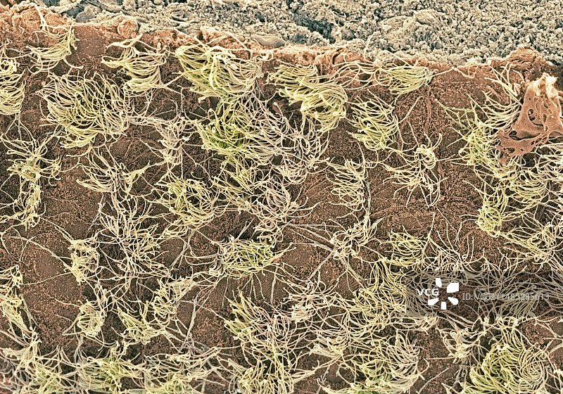 大脑表面扫描电镜图图片素材