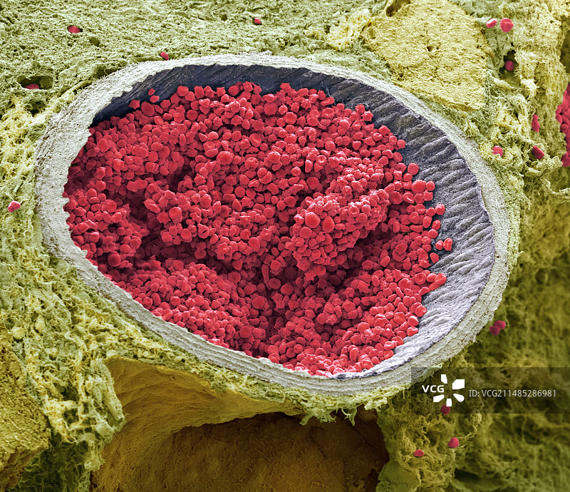 充满血液的胎儿主动脉扫描电镜图图片素材