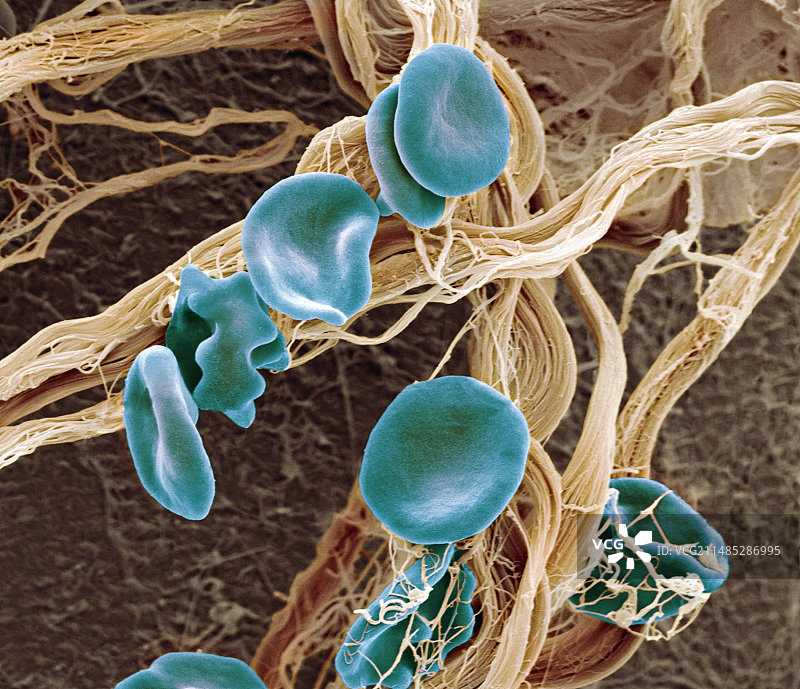 红细胞扫描电子显微镜图像图片素材