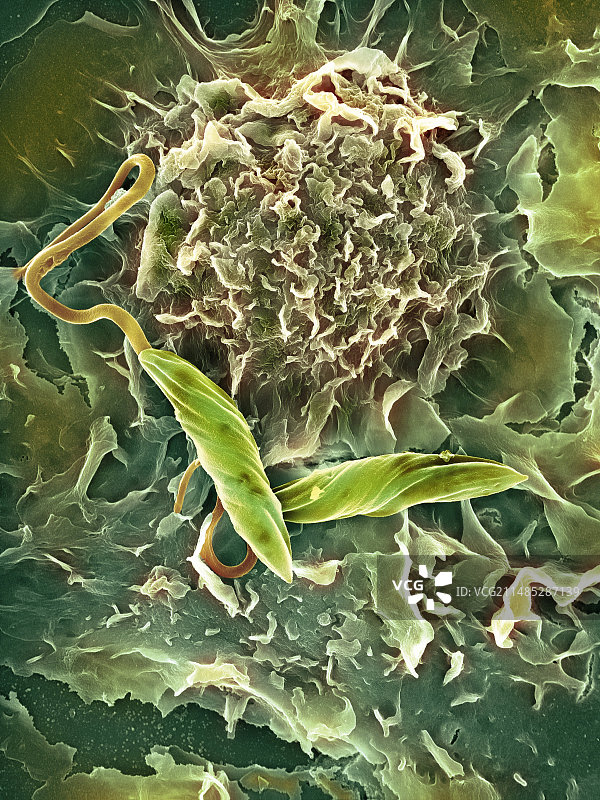 巨噬细胞攻击异物，扫描电镜图片素材