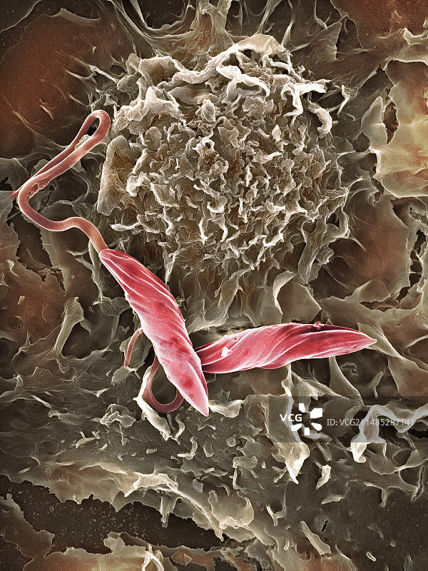 巨噬细胞攻击异物，扫描电镜图片素材