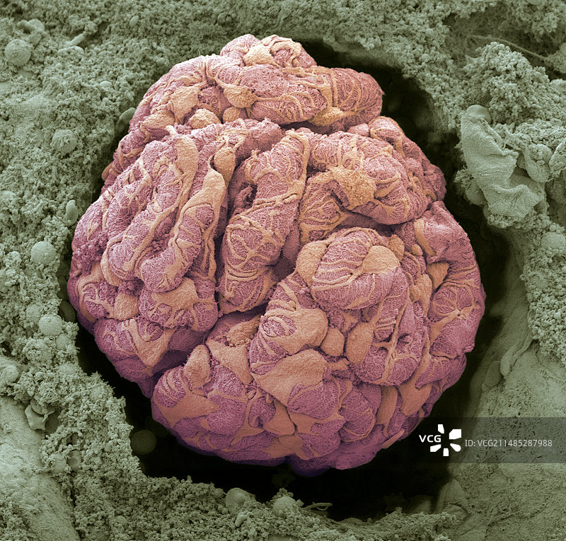 肾小球扫描电镜图图片素材