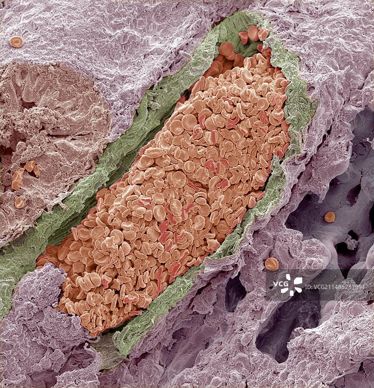 充满血液的肺静脉扫描电镜图片素材