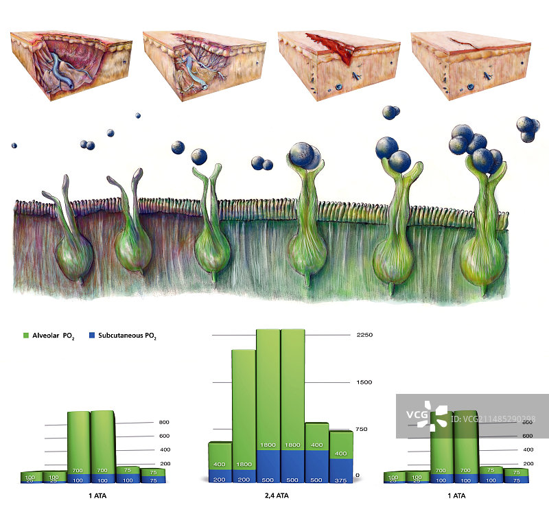 伤口护理凝胶疗法，艺术作品图片素材