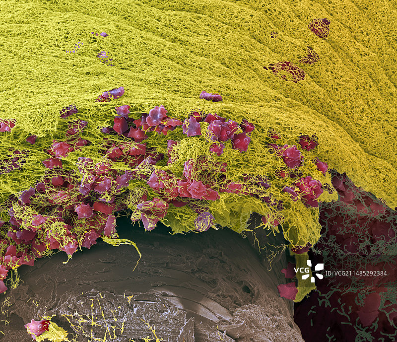 血栓扫描电镜图片素材