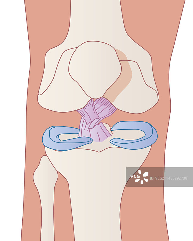 受损的膝盖韧带（艺术作品）图片素材