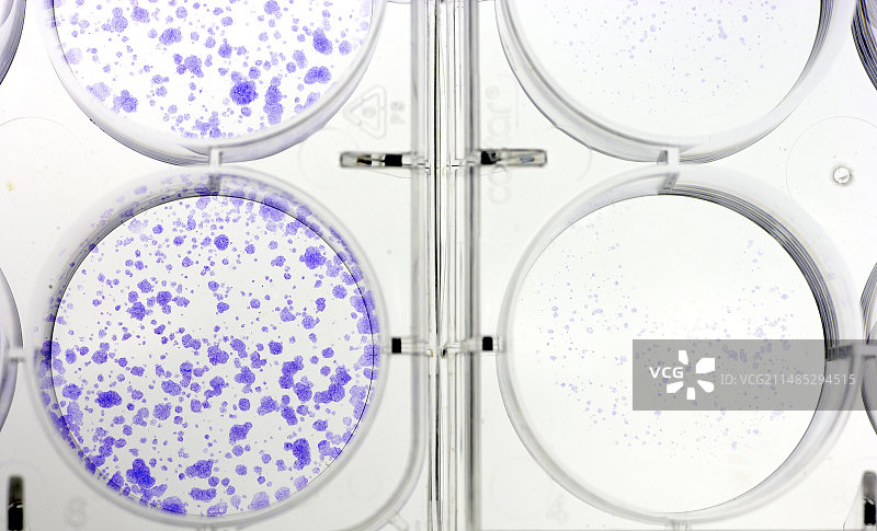 乳腺癌治疗研究图片素材