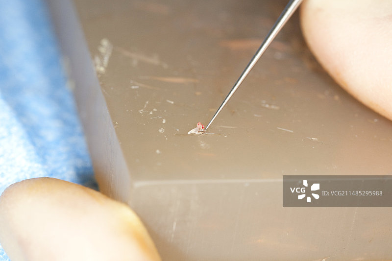 中耳手术图片素材