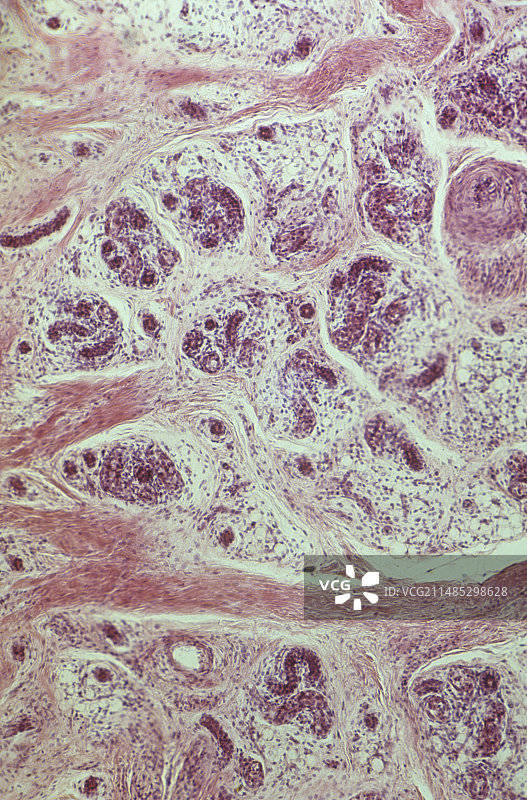 带汗腺的人体皮肤局部图片素材