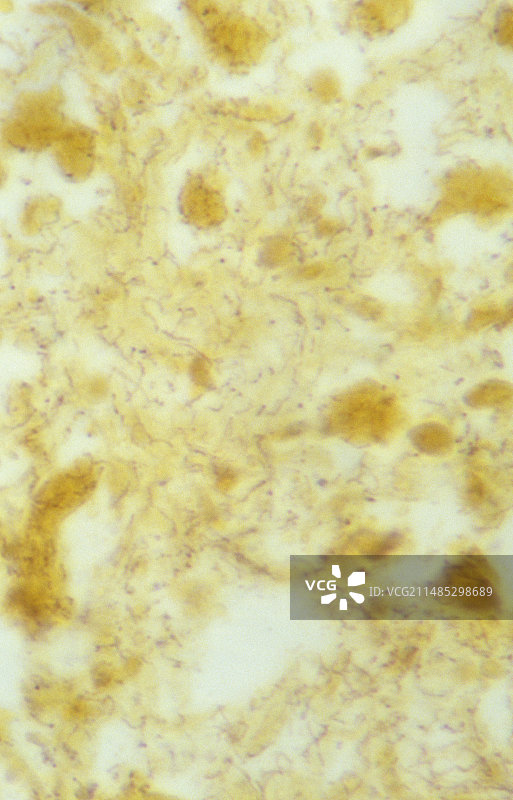 螺旋体细菌（梅毒螺旋体）图片素材