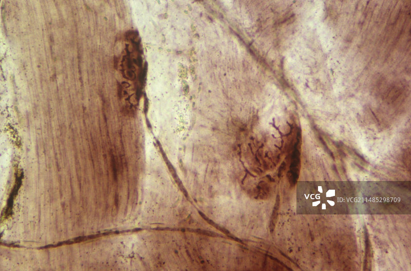 骨骼肌中的运动终板图片素材