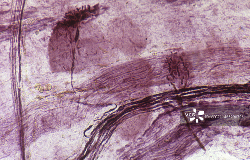 随意肌中的马达端板显微图图片素材