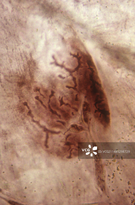 骨骼肌中的运动终板图片素材