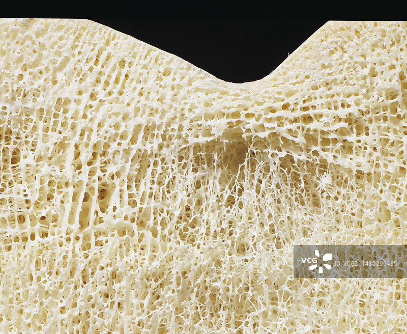 股骨和腿部截面图图片素材