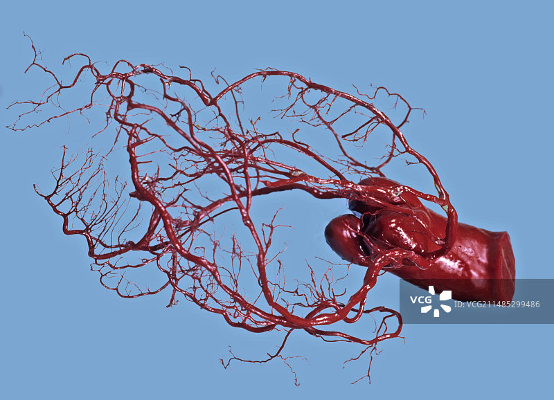 患病动脉的人体心脏图片素材