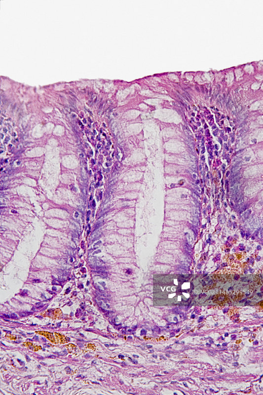 阑尾柱状上皮细胞结构示意图图片素材