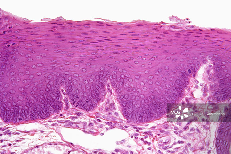 复层鳞状上皮图片素材