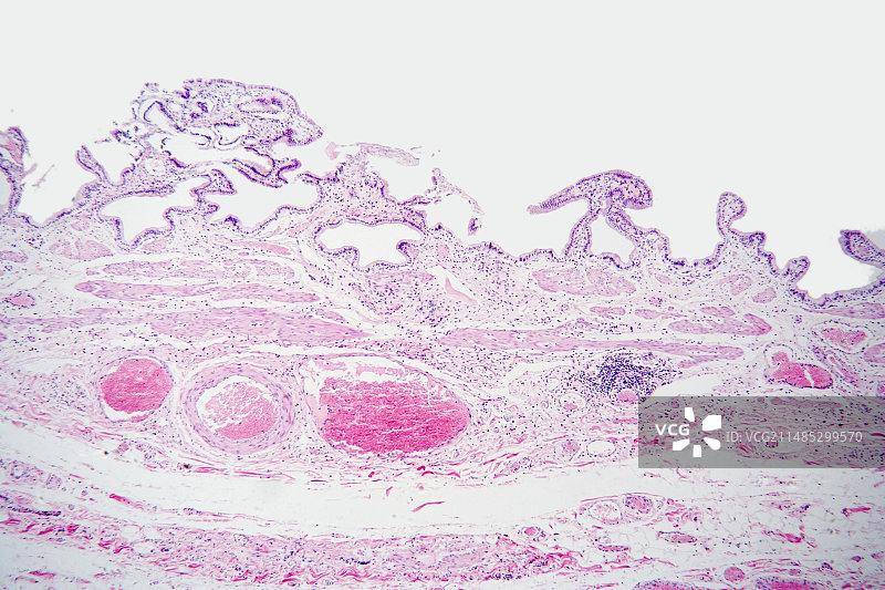 人胆囊切片显微图图片素材