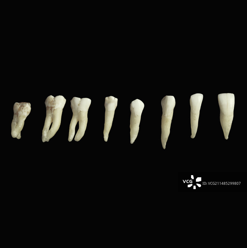 成人牙齿半套（左上）图片素材