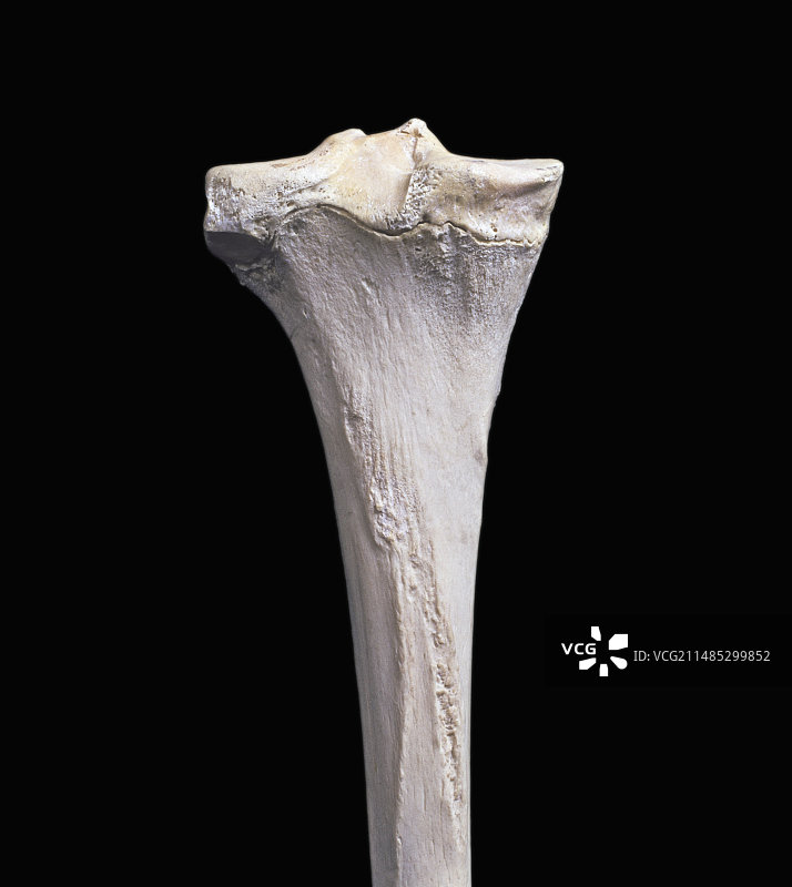 胫骨上端后视图图片素材