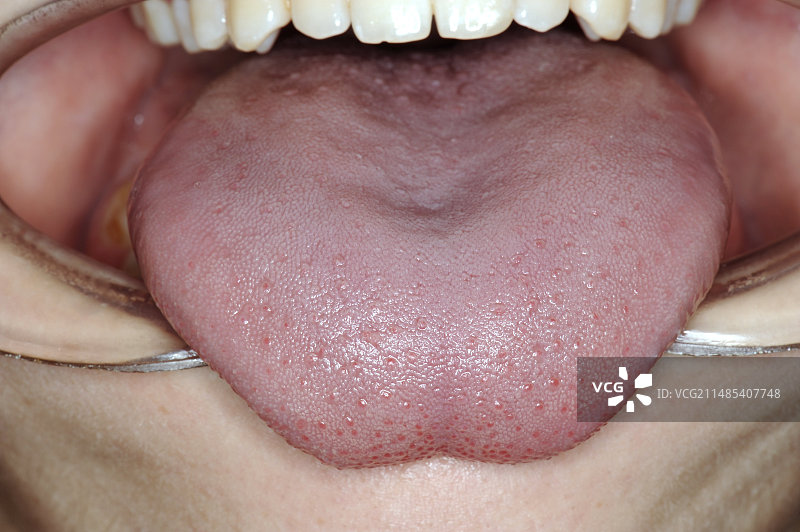 舌系带图片素材