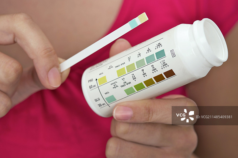 尿液测试结果图片素材