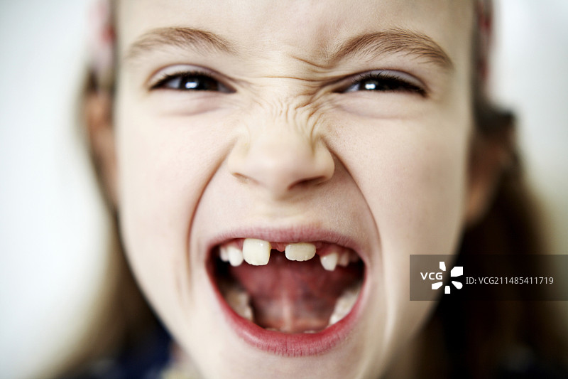 乳牙脱落图片素材