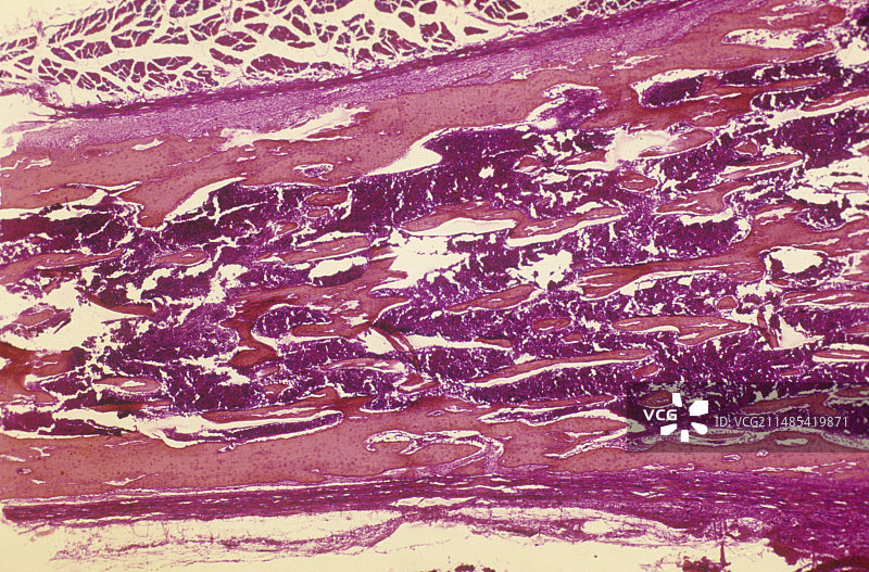 人类长骨和骨髓发育图片素材
