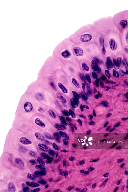 膀胱的移行上皮图片素材