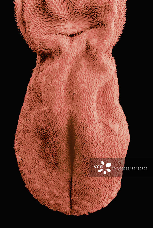 人类舌头表面及乳突扫描电镜图图片素材