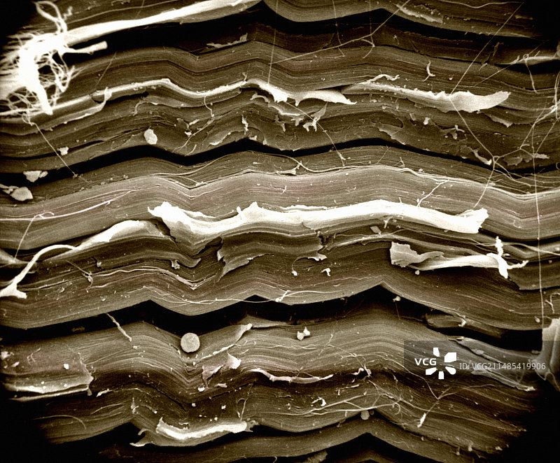 致密结缔组织扫描电镜图图片素材