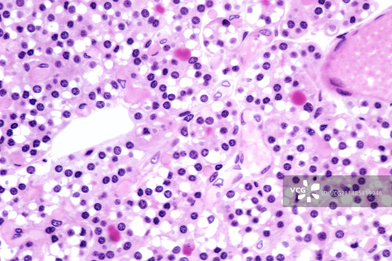 人体甲状旁腺图片素材